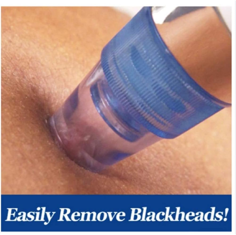 Electric Pore Cleaning Blackheads Removing Device